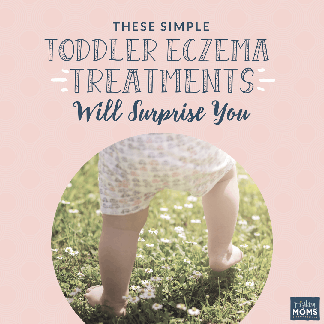 Treating toddler eczema at home - MightyMoms.club