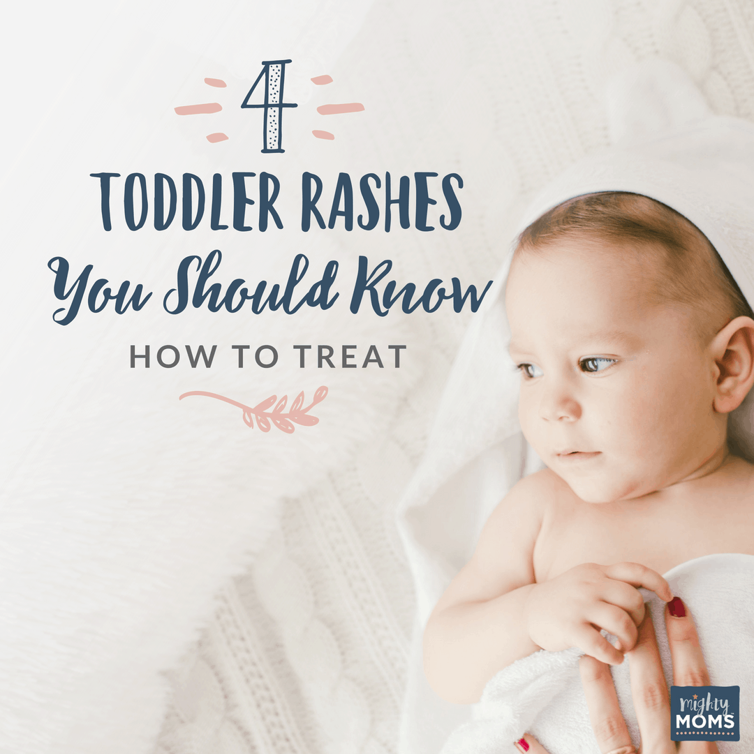 Toddler Rashes to Know About - MightyMoms.club